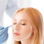 Контурна пластика у FineLine Контурна пластика у FineLine