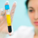 Плазмоліфтинг Fine Line Плазмоліфтинг Fine Line