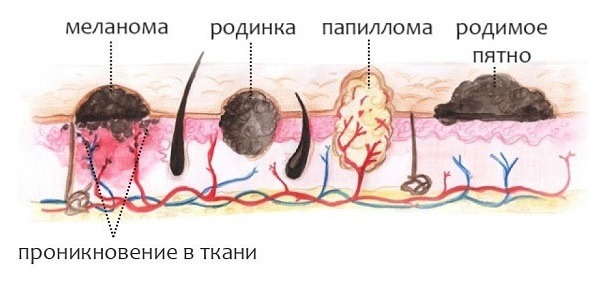 типи новоутворень типи новоутворень