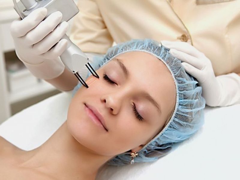 lazer-shlifovka процедура лазерного шліфування