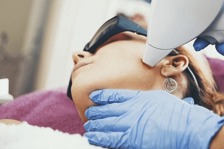 ЛАЗЕРНА ЕПІЛЯЦІЯ - 24/02/2022