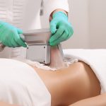 кріоліполіз корекція фігури кріоліполіз корекція фігури