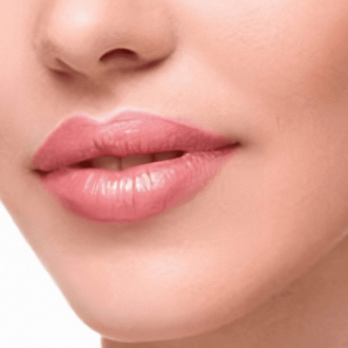 Збільшення губ 9 косметологія у Івано-Франківську FineLine збільшення губ після процедури