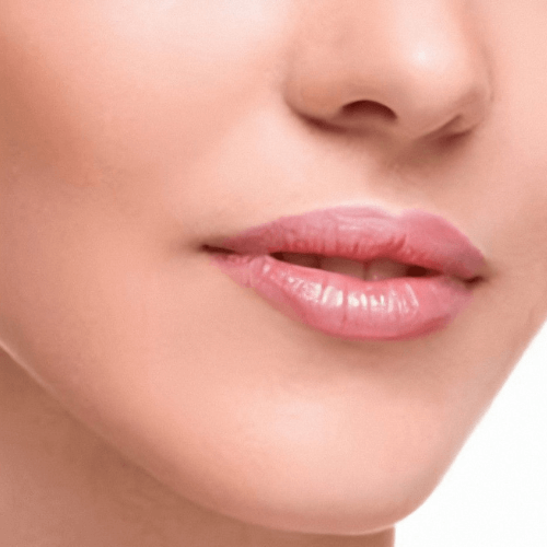 Збільшення губ 8 косметологія у Івано-Франківську FineLine збільшення губ до процедури