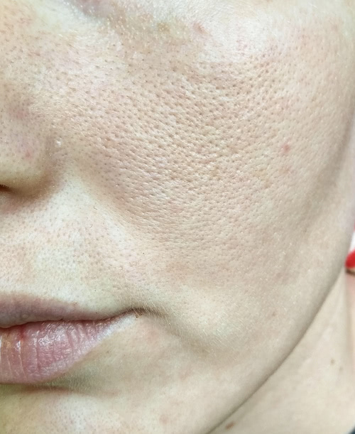 Маски для обличчя 8 косметологія у Івано-Франківську FineLine до використання маски для обличчя