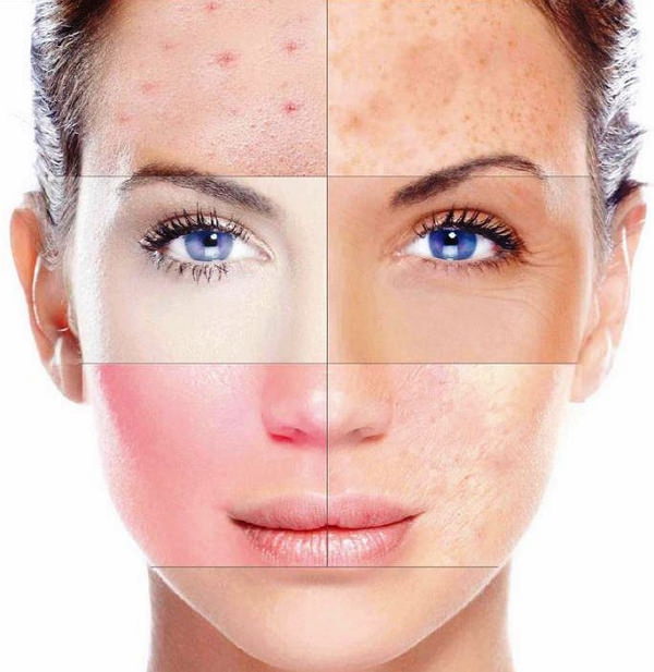 здорова шкіра визначення типу шкіри