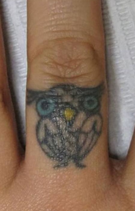 Лазерне видалення тату 8 косметологія у Івано-Франківську FineLine до лазерного видалення тату