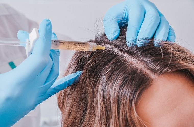Для чого робити мезотерапію волосся?