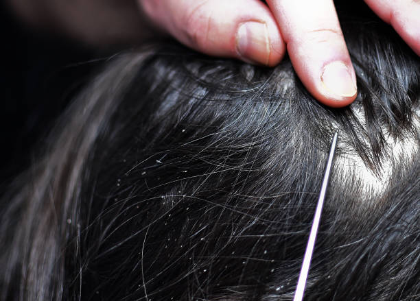 Апаратна діагностика волосся: чому без трихоскопії лікування малоефективне