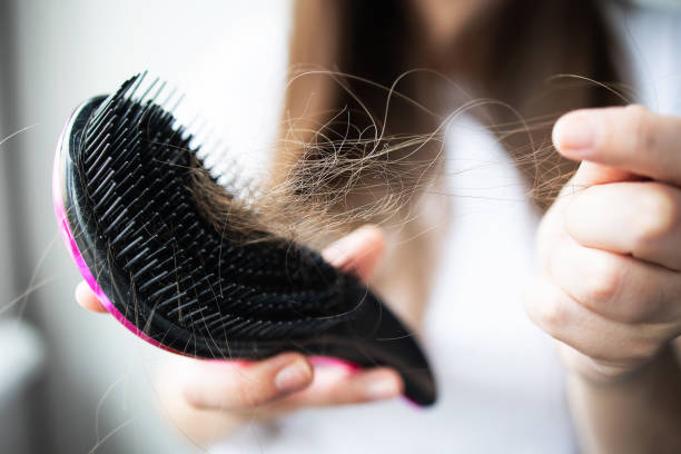 Весняне випадіння волосся: як зупинити процес і повернути густоту